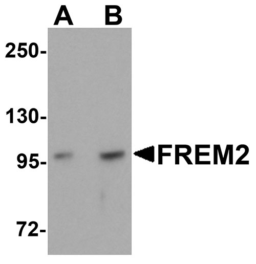 1 - FREM2 Antibody ASC11160