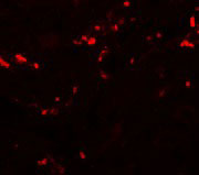 3 - TCTN1 Antibody ASC11161