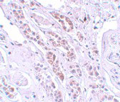 2 - TCTN1 Antibody ASC11161