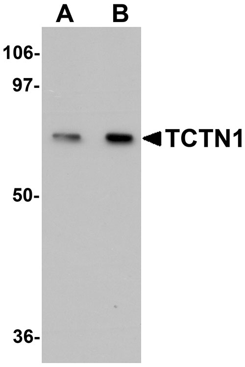 1 - TCTN1 Antibody ASC11161