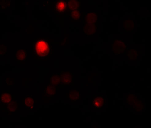 3 - TCTN3 Antibody ASC11163