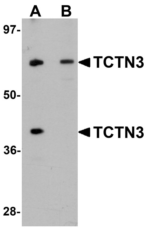 1 - TCTN3 Antibody ASC11163
