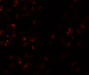 3 - SCUBE1 Antibody ASC11165