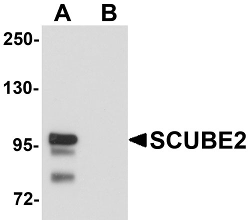 1 - SCUBE2 Antibody ASC11166
