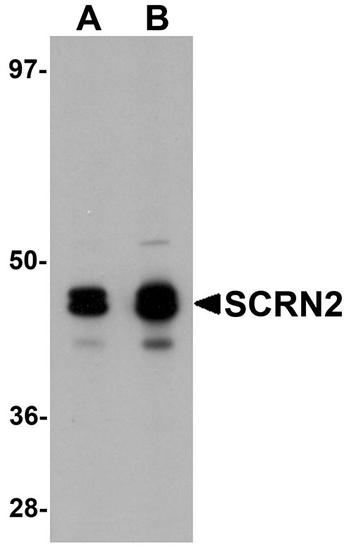 1 - SCRN2 Antibody ASC11169
