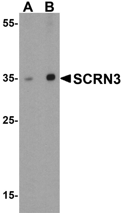 1 - SCRN3 Antibody ASC11170