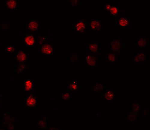 3 - ATP11A Antibody ASC11171