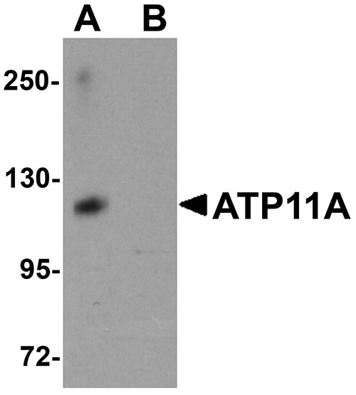 1 - ATP11A Antibody ASC11171