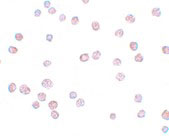 8 - ATP11B Antibody ASC11172