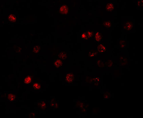 3 - ATP11B Antibody ASC11172