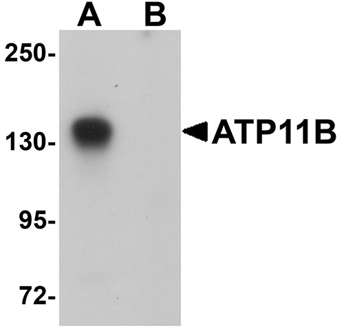 1 - ATP11B Antibody ASC11172