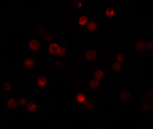 3 - CaBP7 Antibody ASC11173