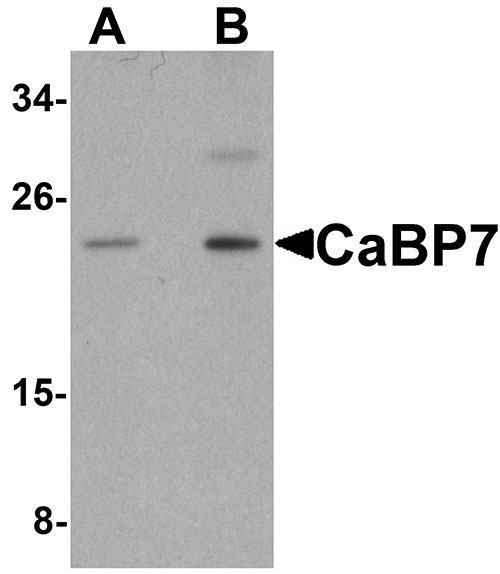 1 - CaBP7 Antibody ASC11173