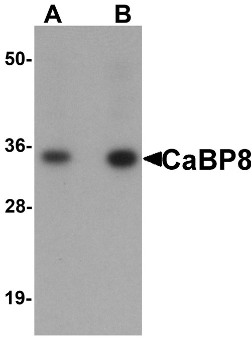 1 - CaBP8 Antibody ASC11174