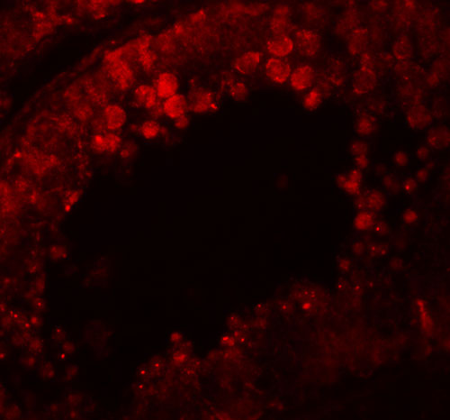 3 - CRISP2 Antibody ASC11180