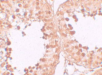 2 - CRISP2 Antibody ASC11180