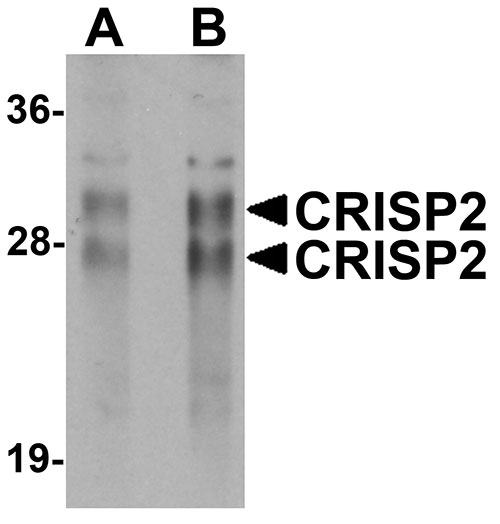 1 - CRISP2 Antibody ASC11180