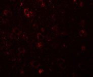 3 - SESTD1 Antibody ASC11182