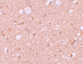 2 - SESTD1 Antibody ASC11182