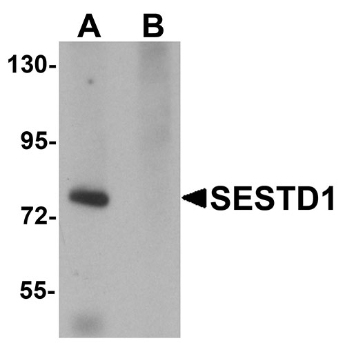 1 - SESTD1 Antibody ASC11182