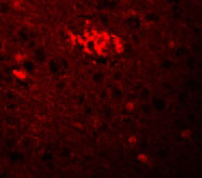 3 - TRIM71 Antibody ASC11183