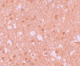 2 - TRIM71 Antibody ASC11183