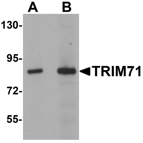 1 - TRIM71 Antibody ASC11183