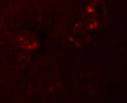 3 - NALP5 Antibody ASC11194