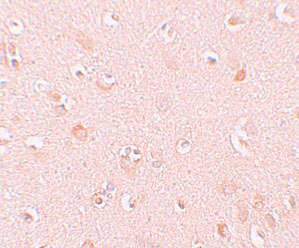2 - NALP5 Antibody ASC11194