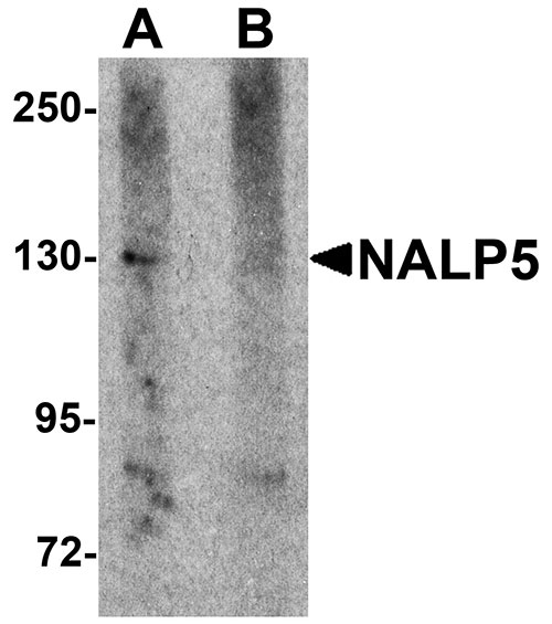 1 - NALP5 Antibody ASC11194