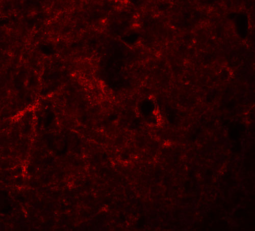 3 - NALP7 Antibody ASC11196