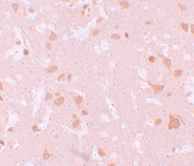 2 - NALP7 Antibody ASC11196