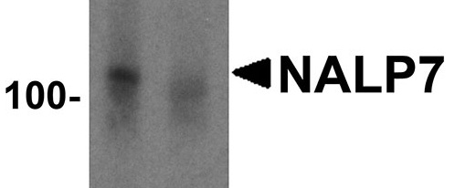 1 - NALP7 Antibody ASC11196