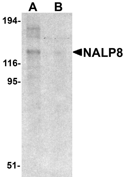 1 - NALP8 Antibody ASC11197