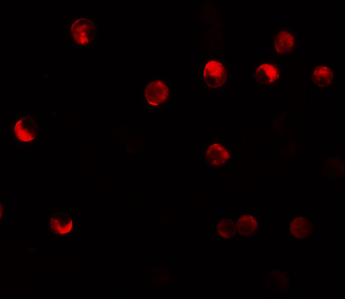 3 - NALP11 Antibody ASC11199