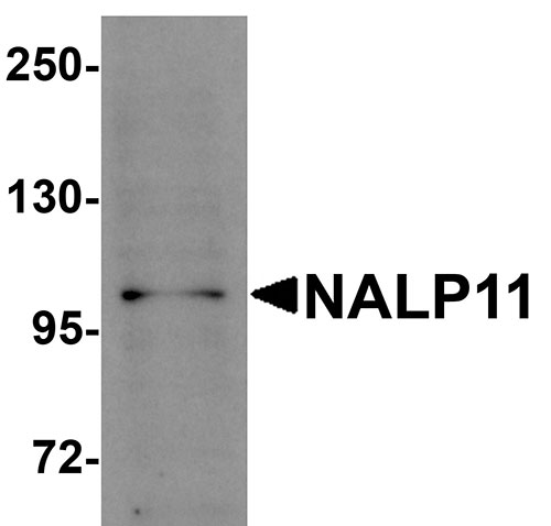 1 - NALP11 Antibody ASC11199