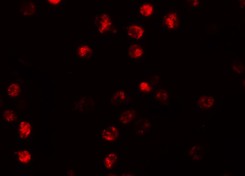 3 - NALP13 Antibody ASC11201