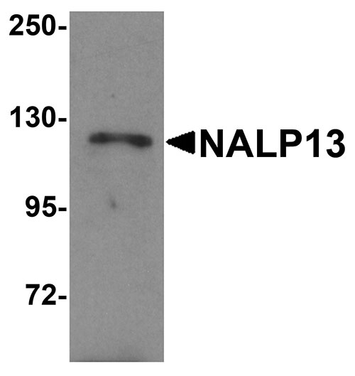 1 - NALP13 Antibody ASC11201