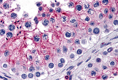 2 - KPNA5 Antibody ASC11209
