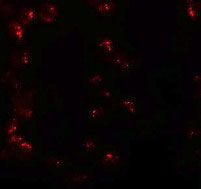 3 - KPNA6 Antibody ASC11210