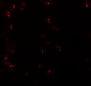 3 - KPNA6 Antibody ASC11210