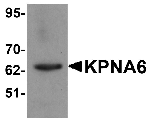 1 - KPNA6 Antibody ASC11210