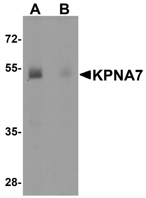 1 - KPNA7 Antibody ASC11211