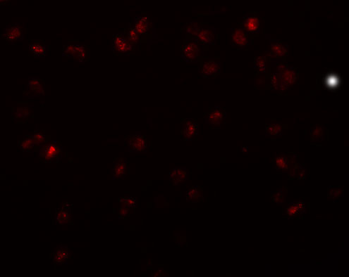 3 - TRIP6 Antibody ASC11215