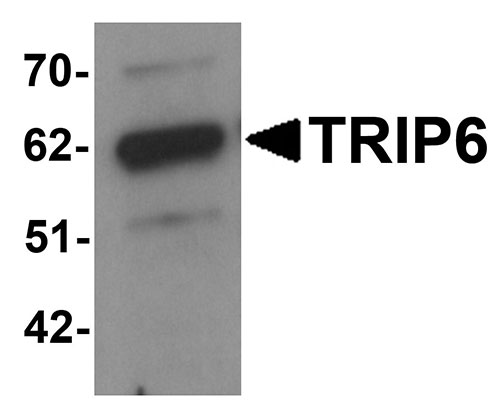 1 - TRIP6 Antibody ASC11215