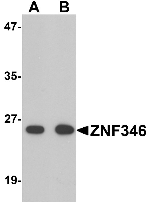 1 - ZNF346 Antibody ASC11216