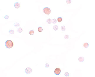 8 - PLAC1 Antibody ASC11219