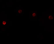 3 - PLAC1 Antibody ASC11219