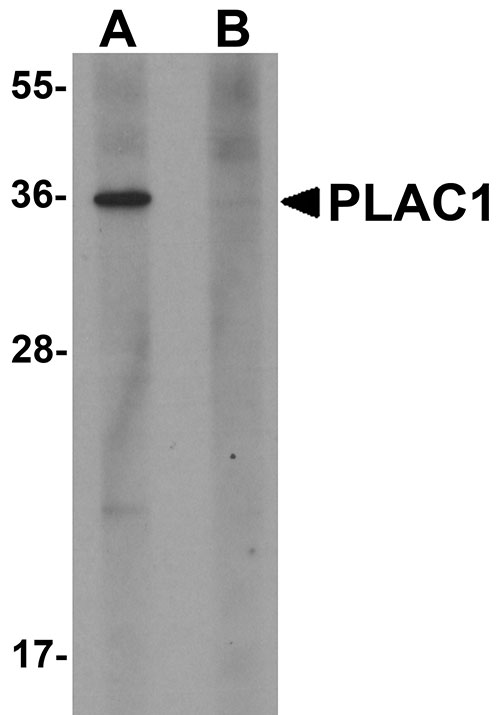 1 - PLAC1 Antibody ASC11219