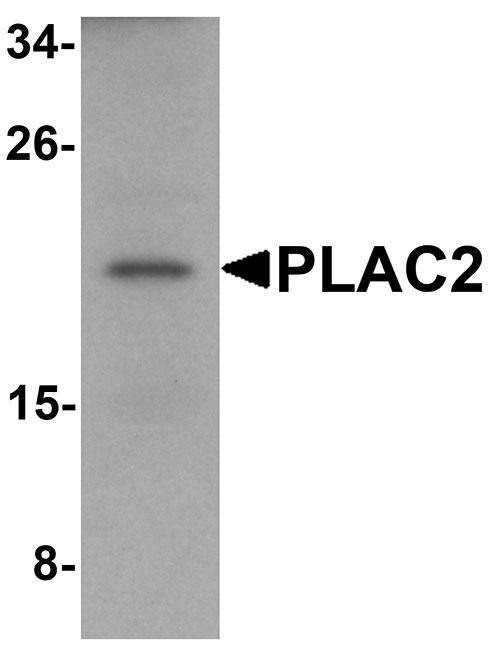 1 - PLAC2 Antibody ASC11220